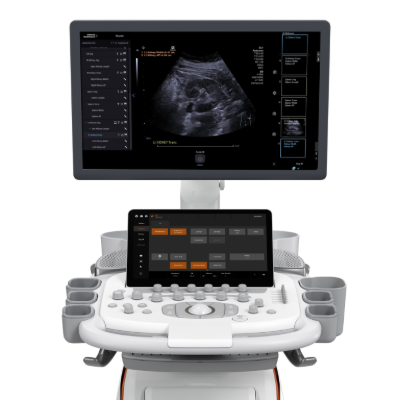 Siemens Acuson Sequoia Ultrasound Machine