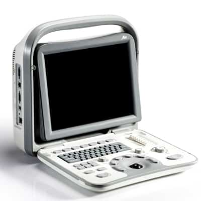 SonoScape A6v