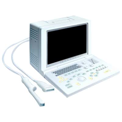 Sonosite SonoScape SSI-1000