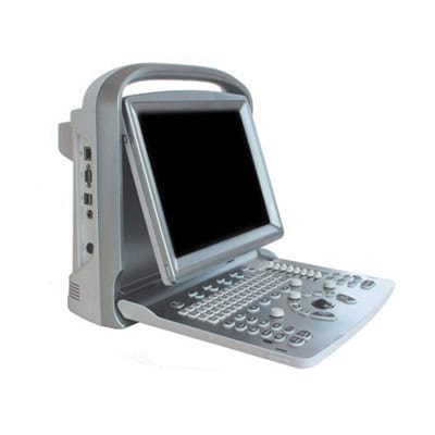 Chison Medical ECO5