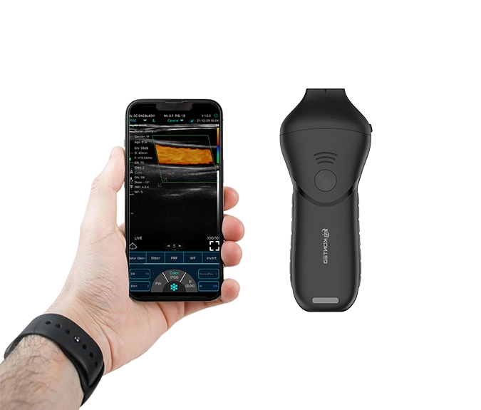 Konted C10MB Pro USB & WiFi High-Frequency Linear Ultrasound Probe